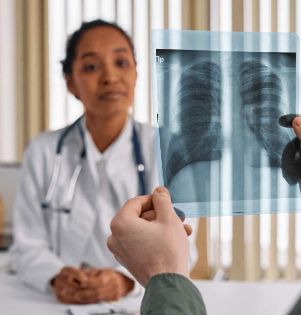 Doctor looking at x-ray of a person's lungs Doctor looking at x-ray of a person's lungs